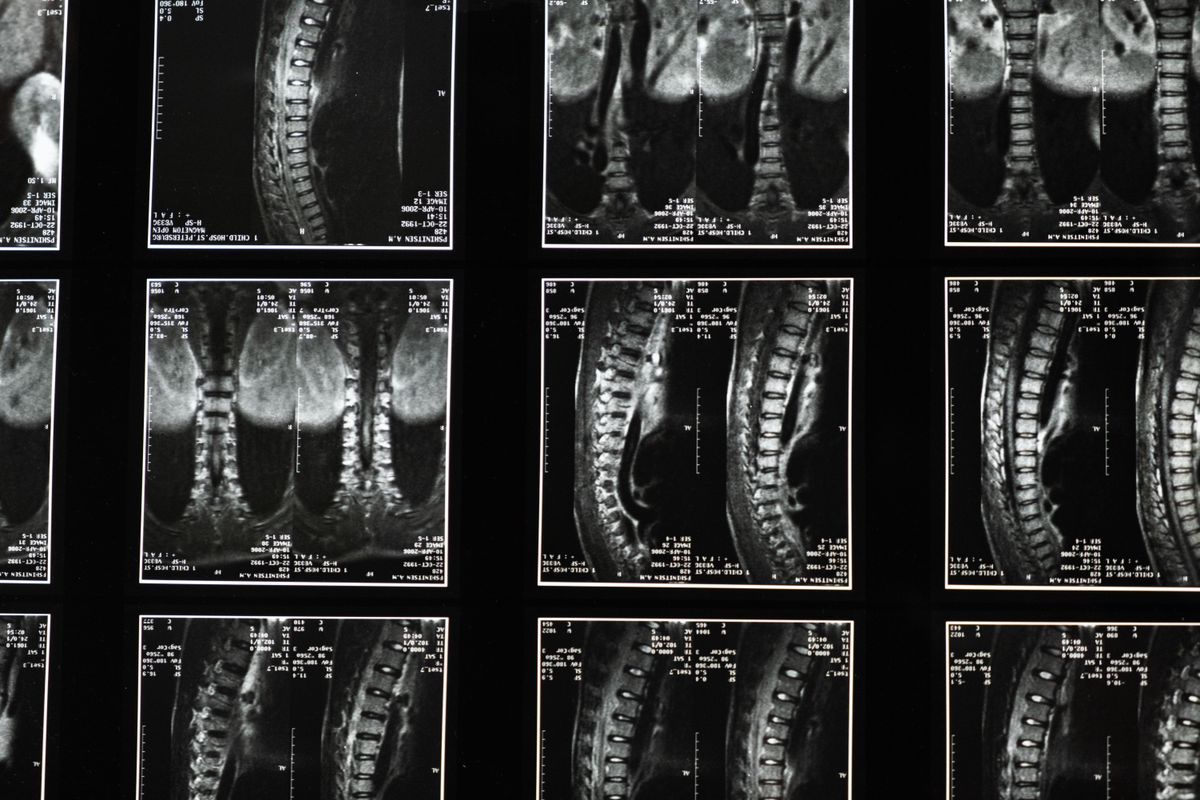 Estudio de imágenes de la columna vertebral